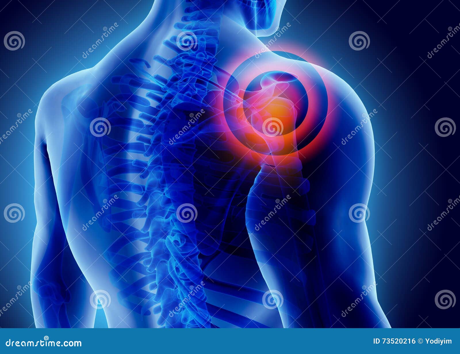 3D Illustration of Shoulder Painful. Stock Illustration Illustration