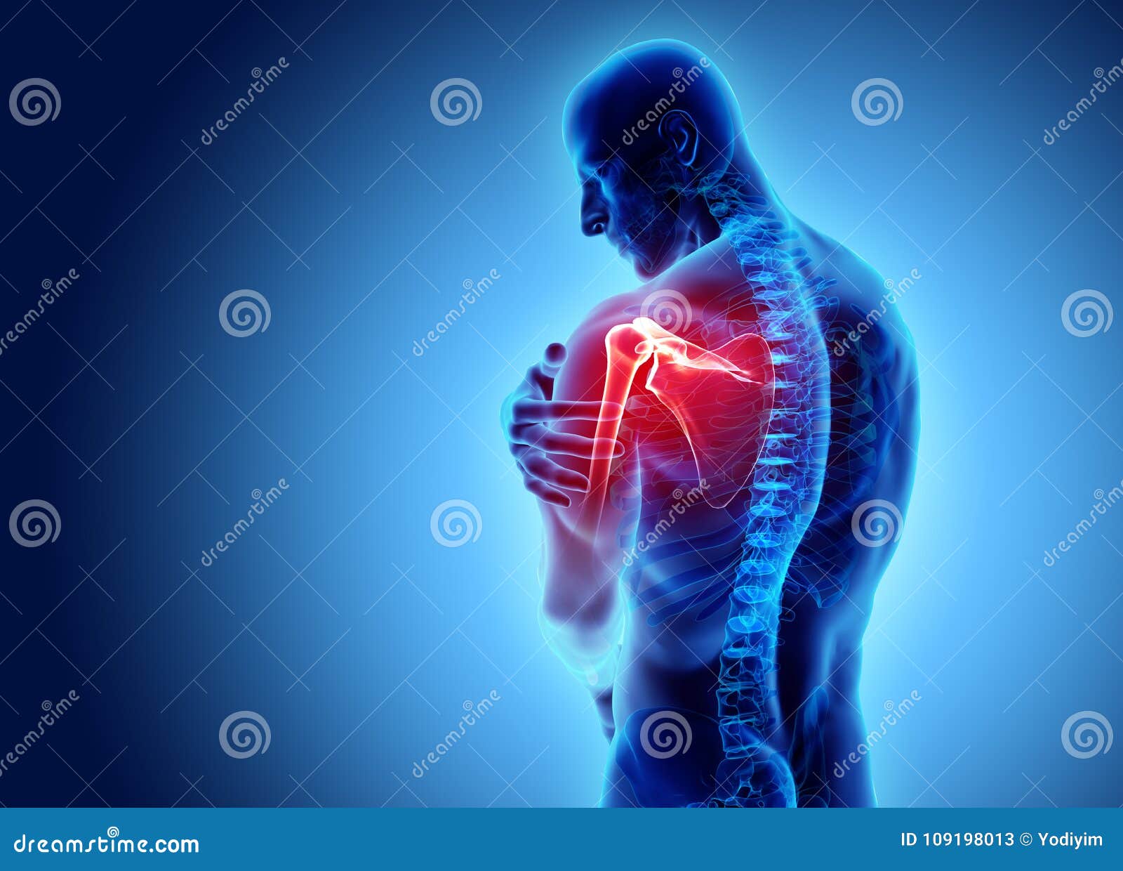 Shoulder Painful Skeleton X-ray, 3D Illustration. Stock Illustration ...