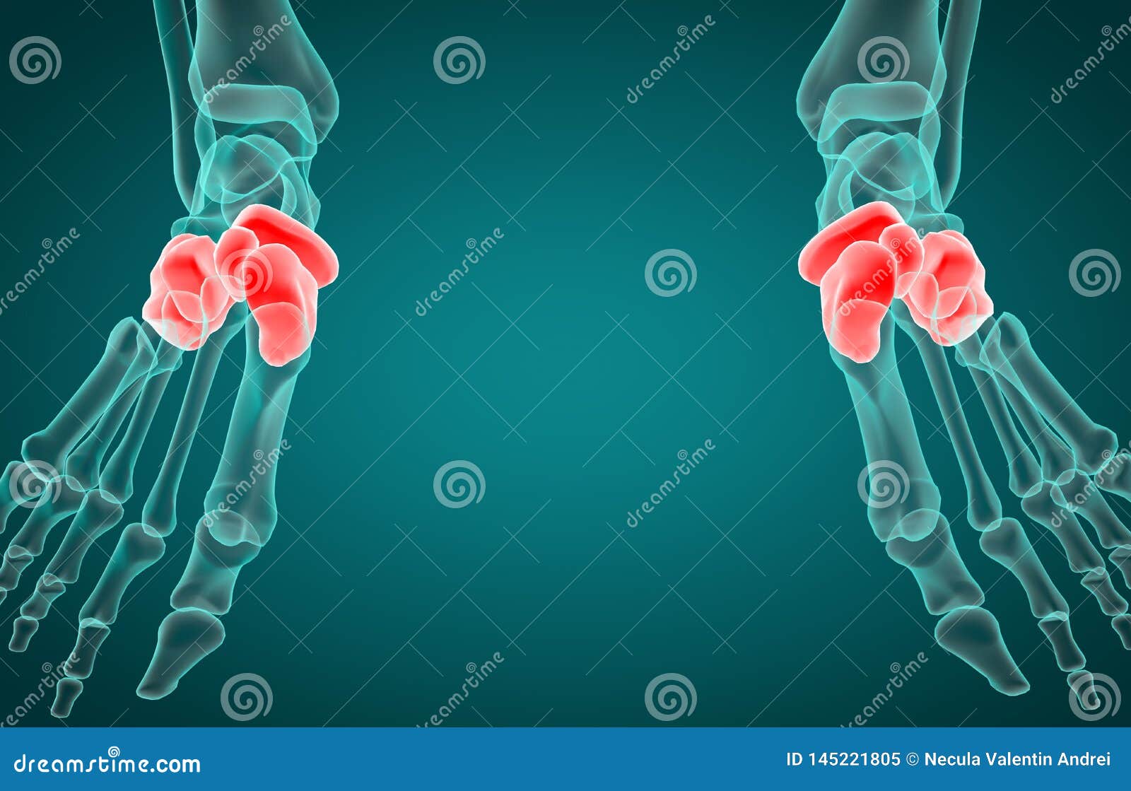 3D Illustration of Tarsal Bone, Xray Stock Illustration Illustration