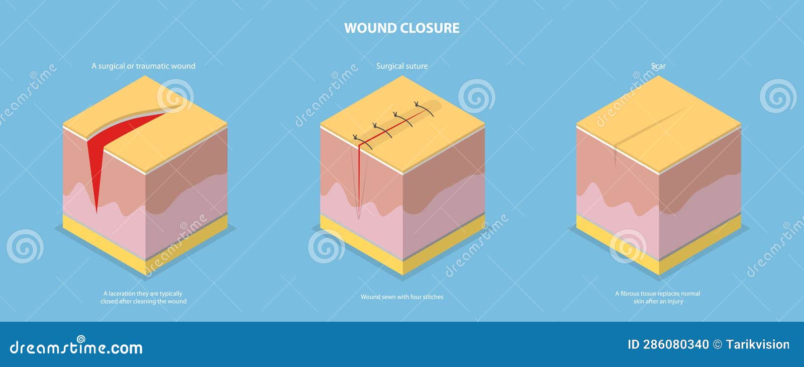 Wound Stock Illustrations – 18,234 Wound Stock Illustrations, Vectors &  Clipart - Dreamstime