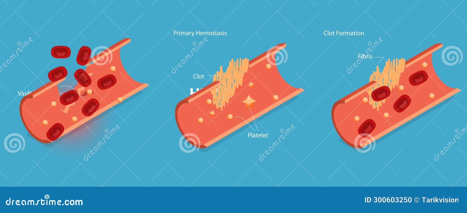 3d isometric flat   of hemostasis