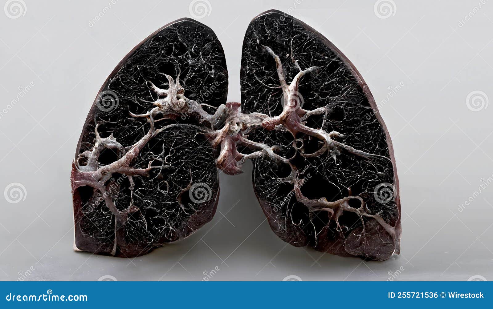 3D Render Of The Black Lungs Of A Heavy Smoker With Tar Stock Photo ...