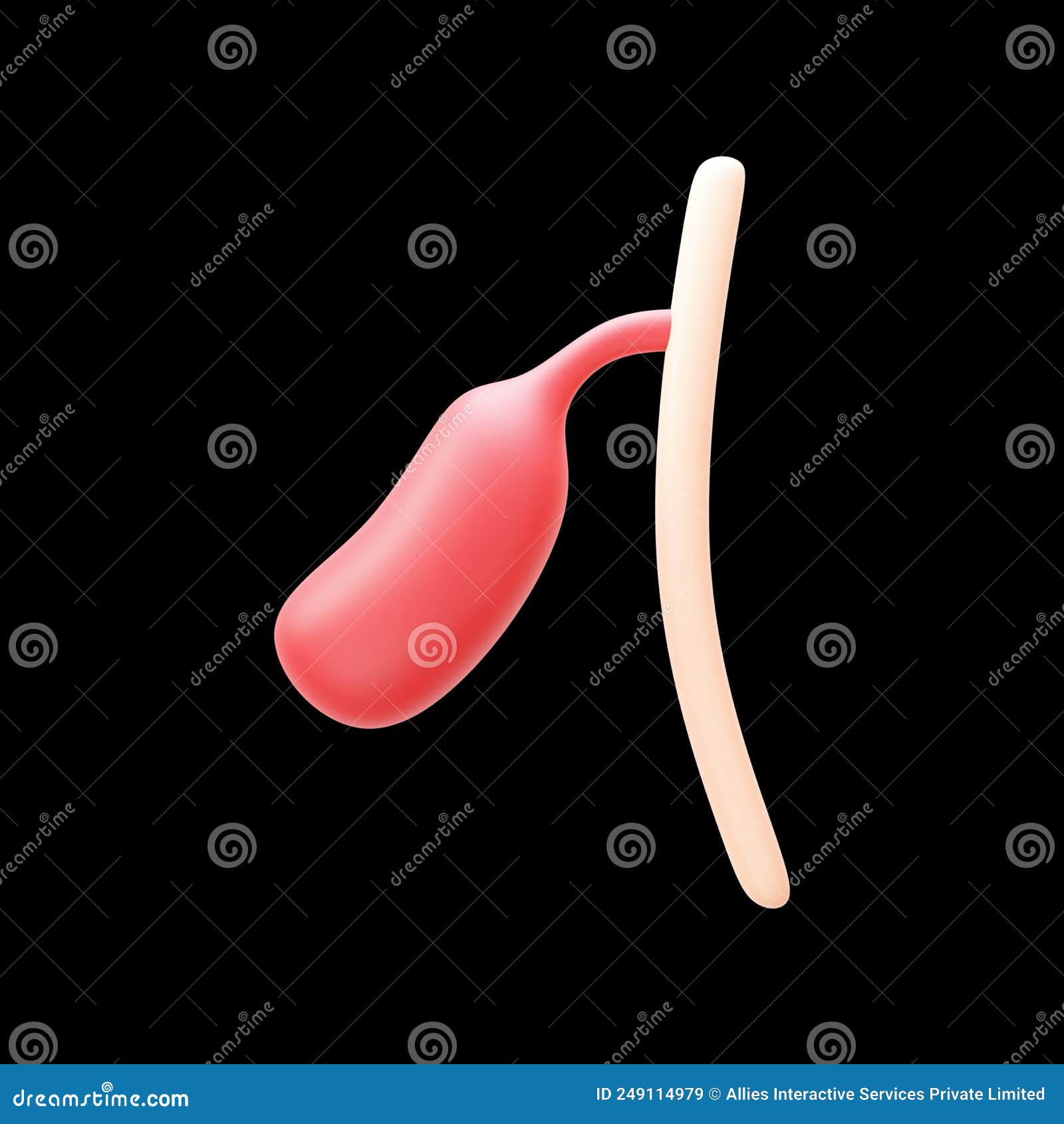 3D Render of Gallbladder Polyps Red Element Over Black Stock Illustration Illustration of