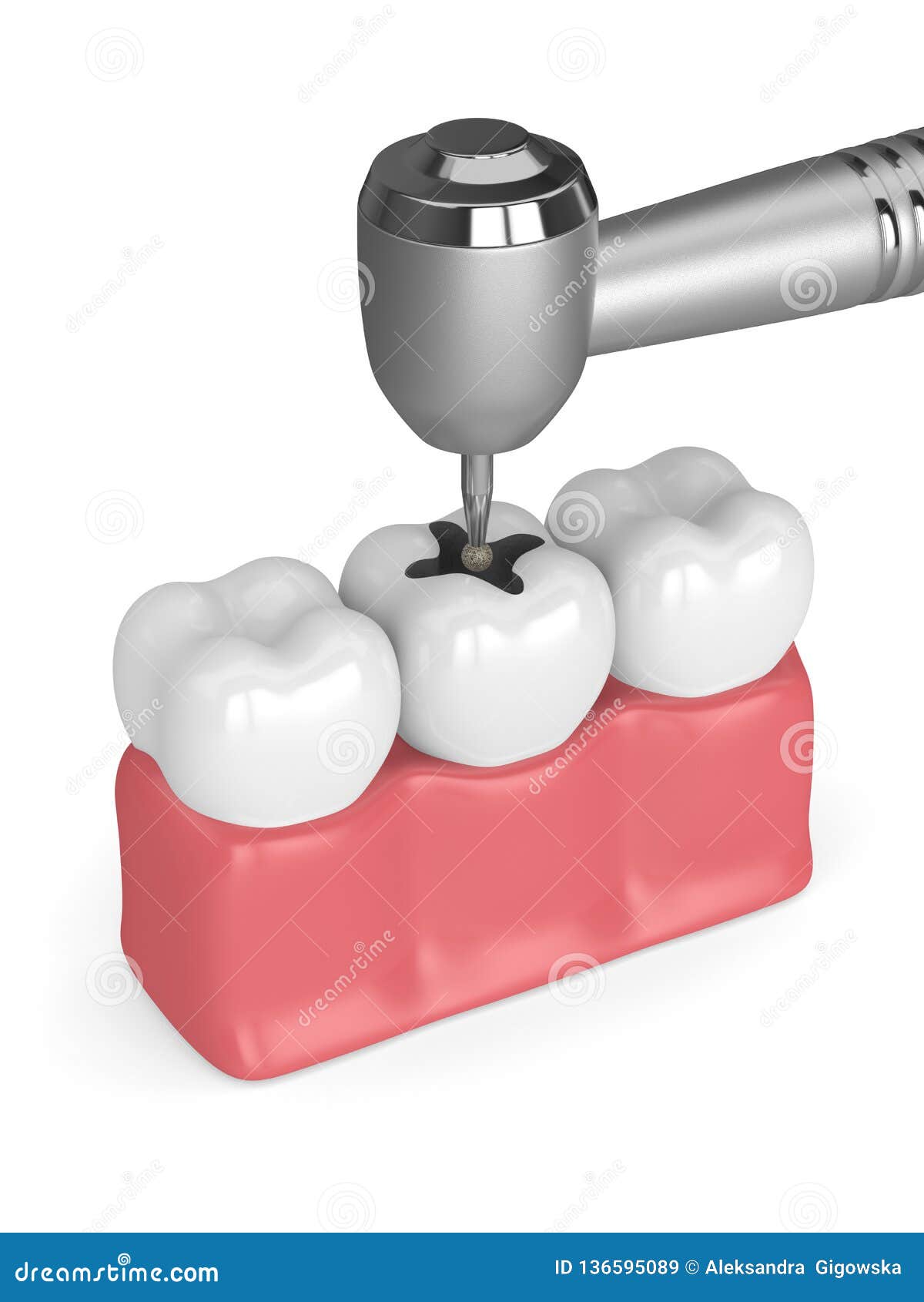 3d Render of Gums with Dental Handpiece and Drill Stock Illustration Illustration of drill