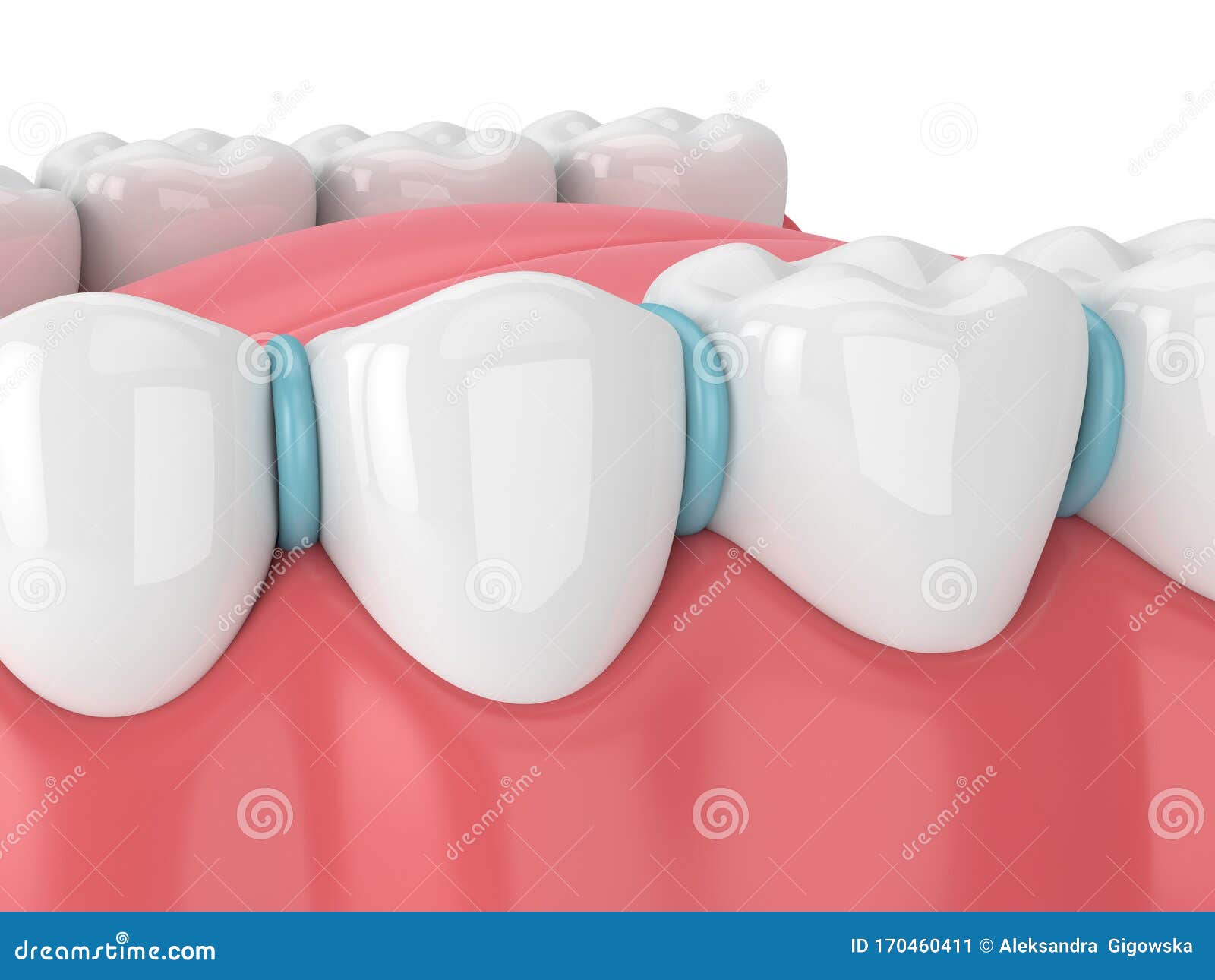 3d Render of Rubber Separator between Teeth Stock Illustration