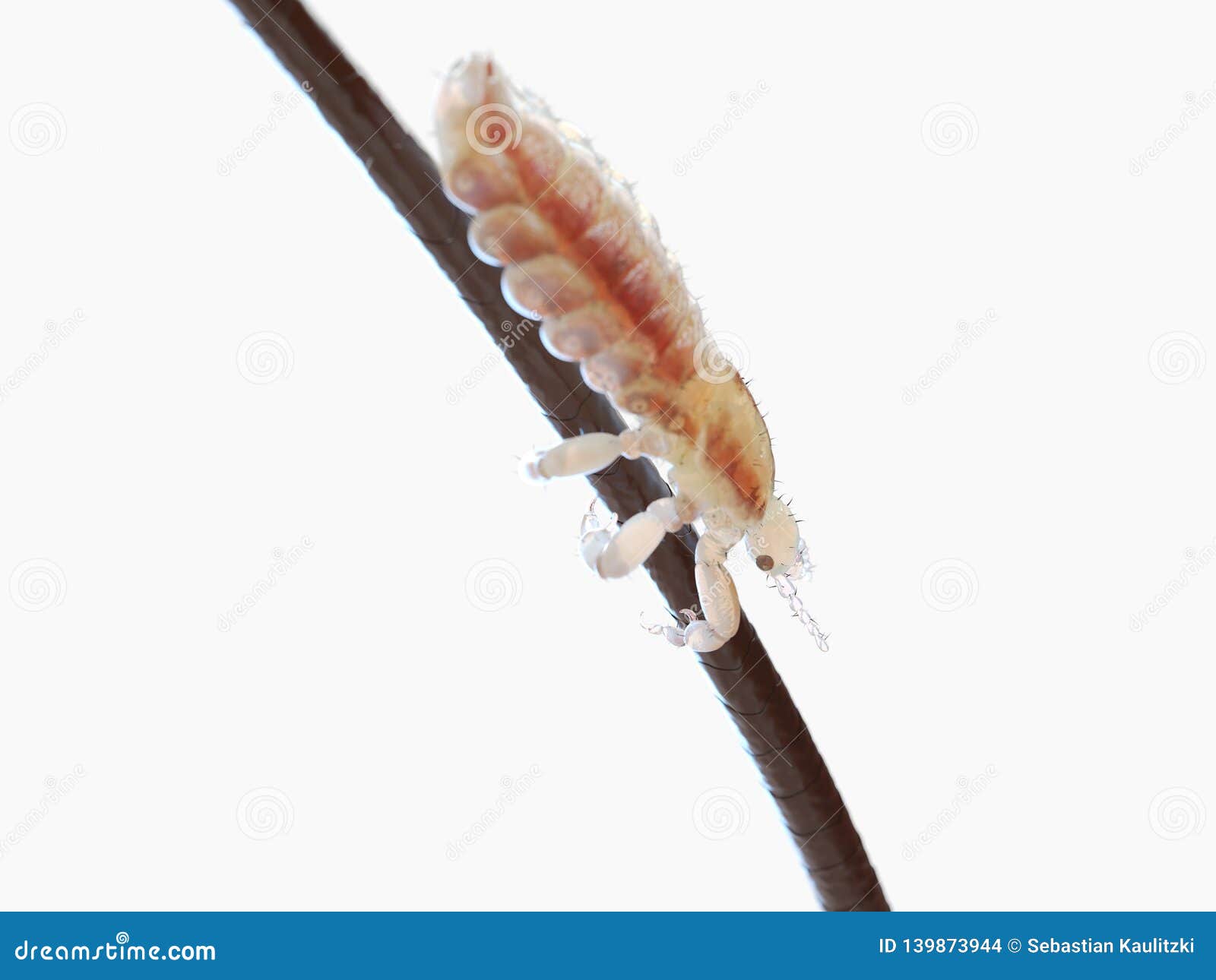 A head louse stock illustration. Illustration of arachnid 139873944