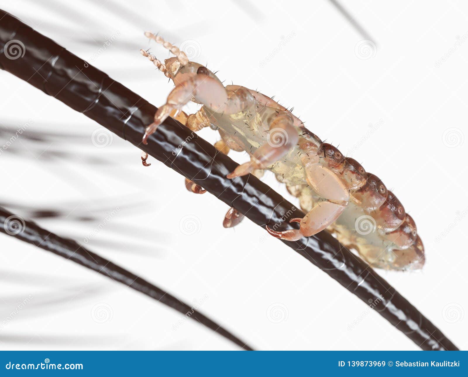 A head louse stock illustration. Illustration of louse 139873969