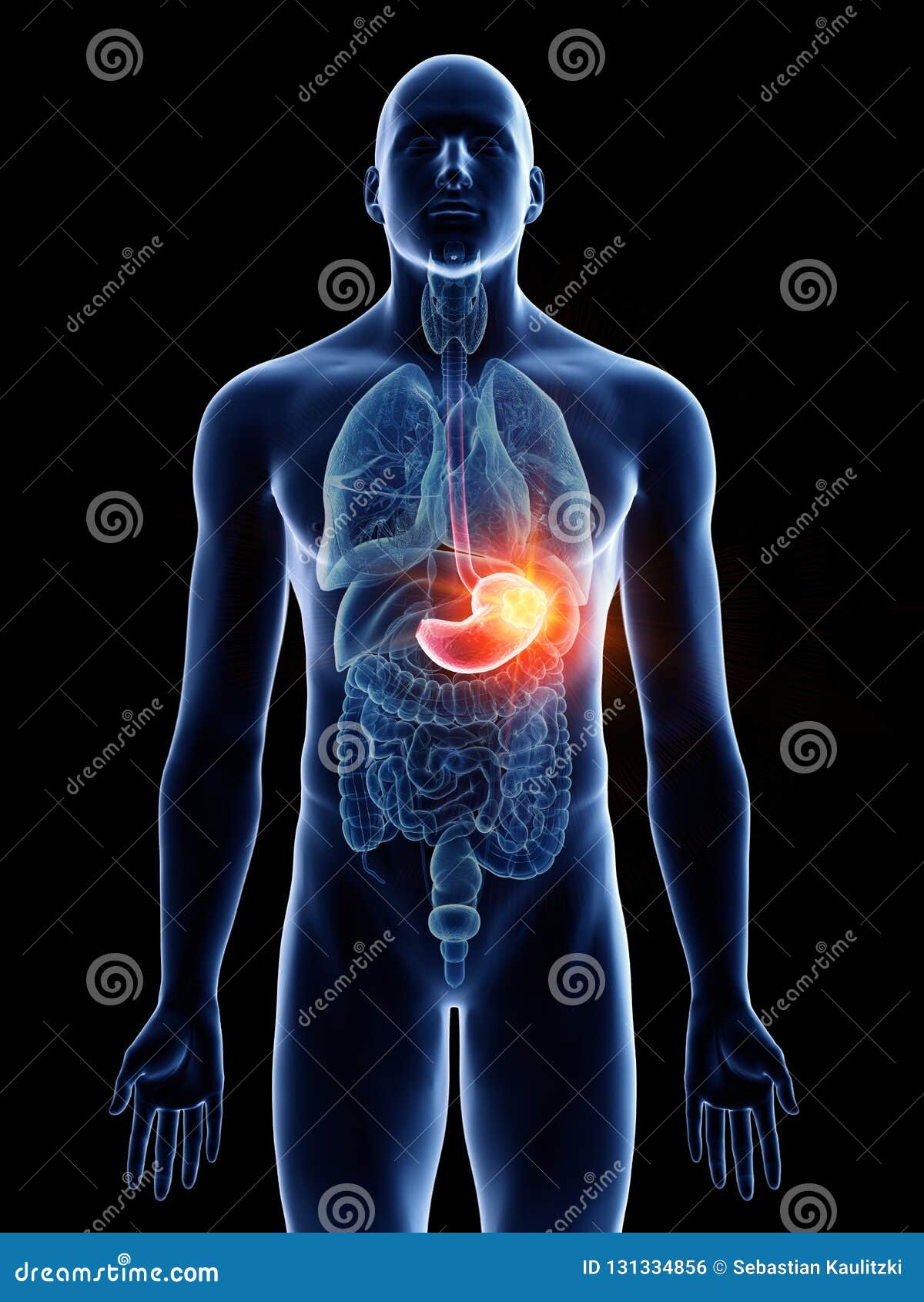 A mans stomach cancer stock illustration. Illustration of frontal ...