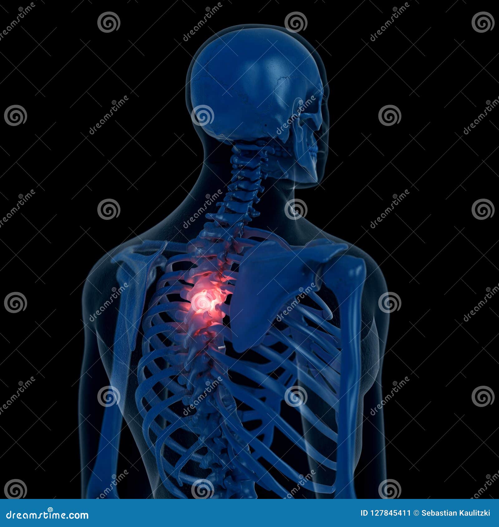 thoracic spine pain thoracic spine pain