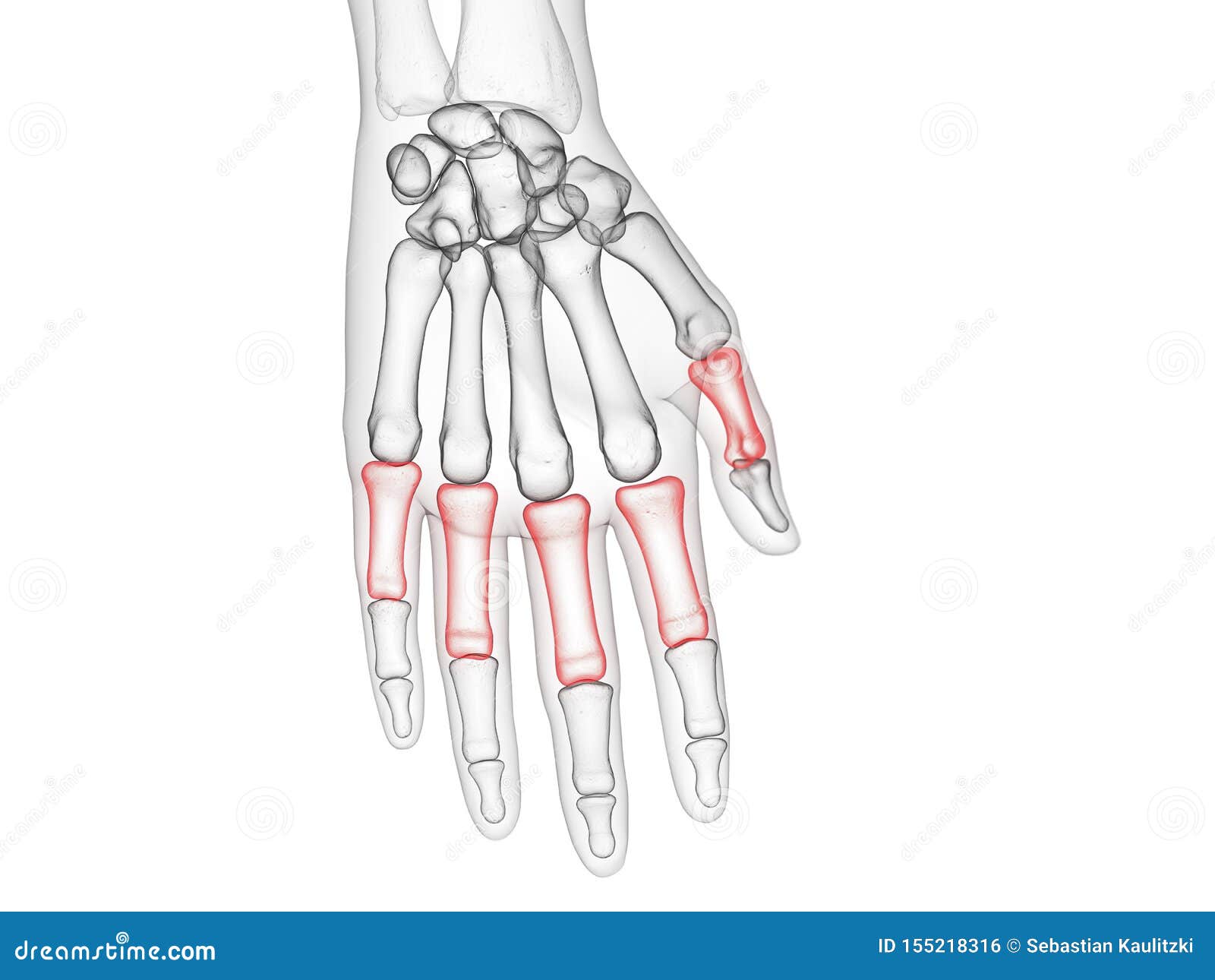 the proximal phalanges