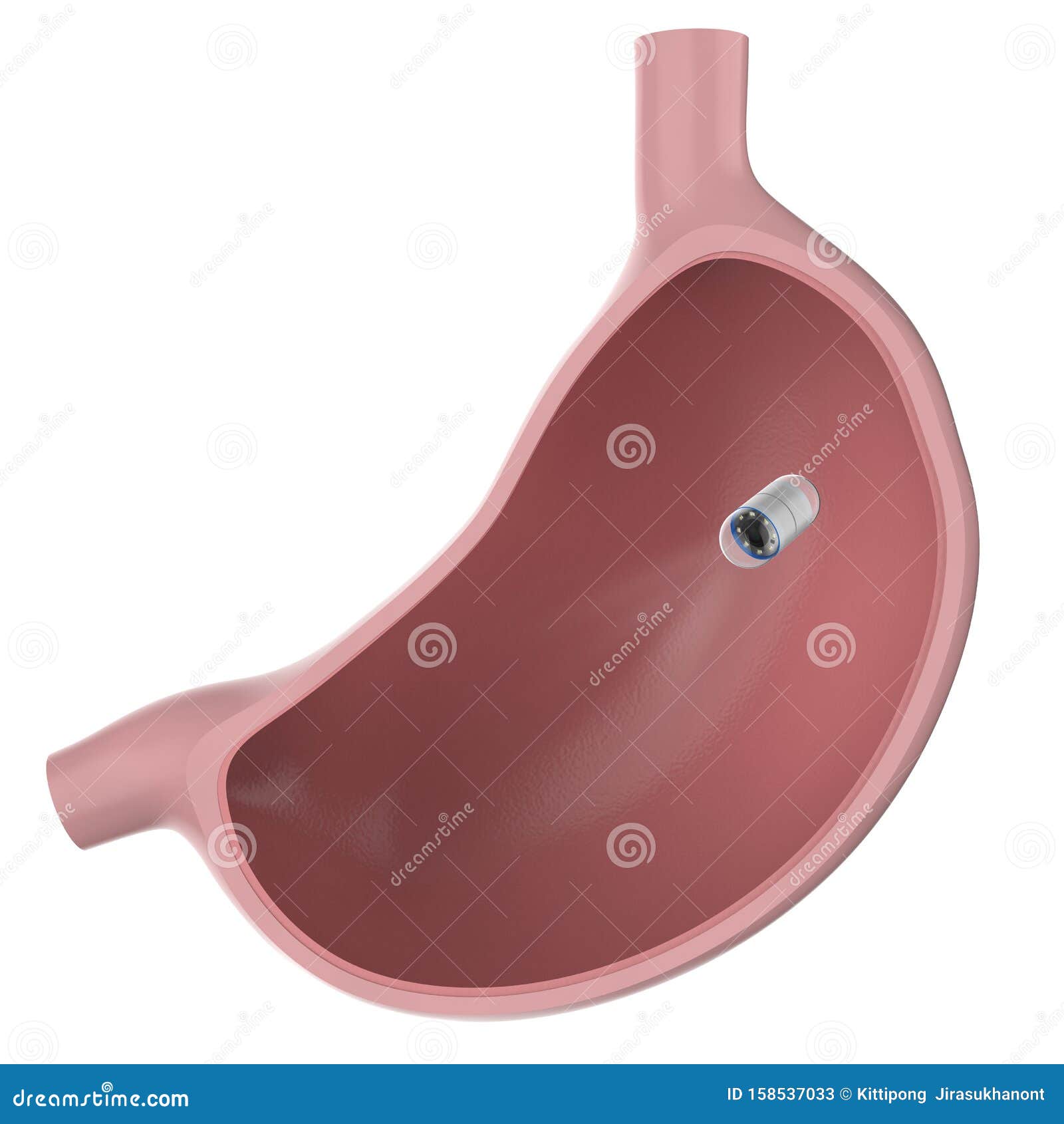Capsule Endoscopy in Stomach Stock Illustration Illustration of