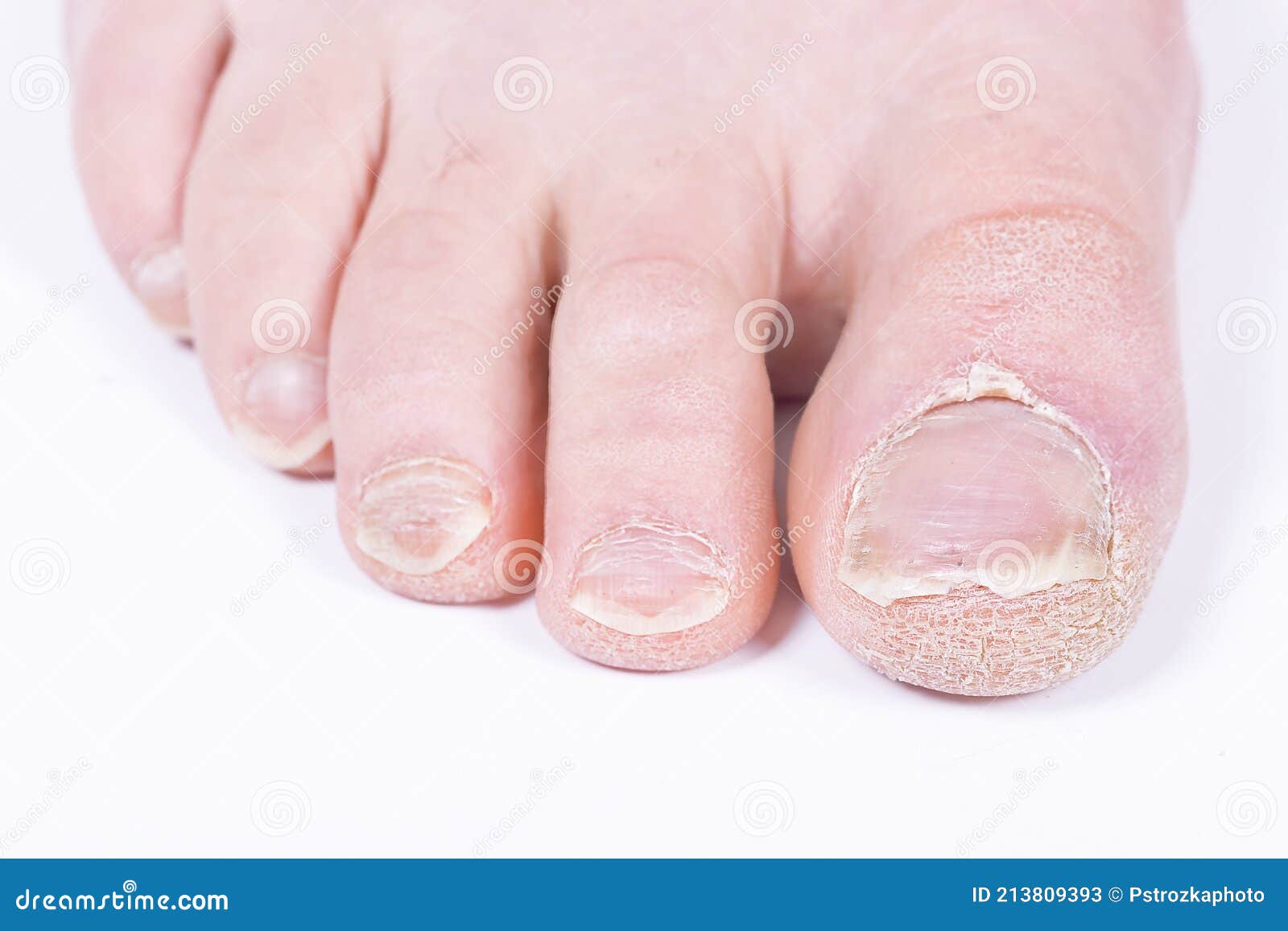 Female Feet with White Manicure Nails Stock Photo - Image of rose, foot:  230293400
