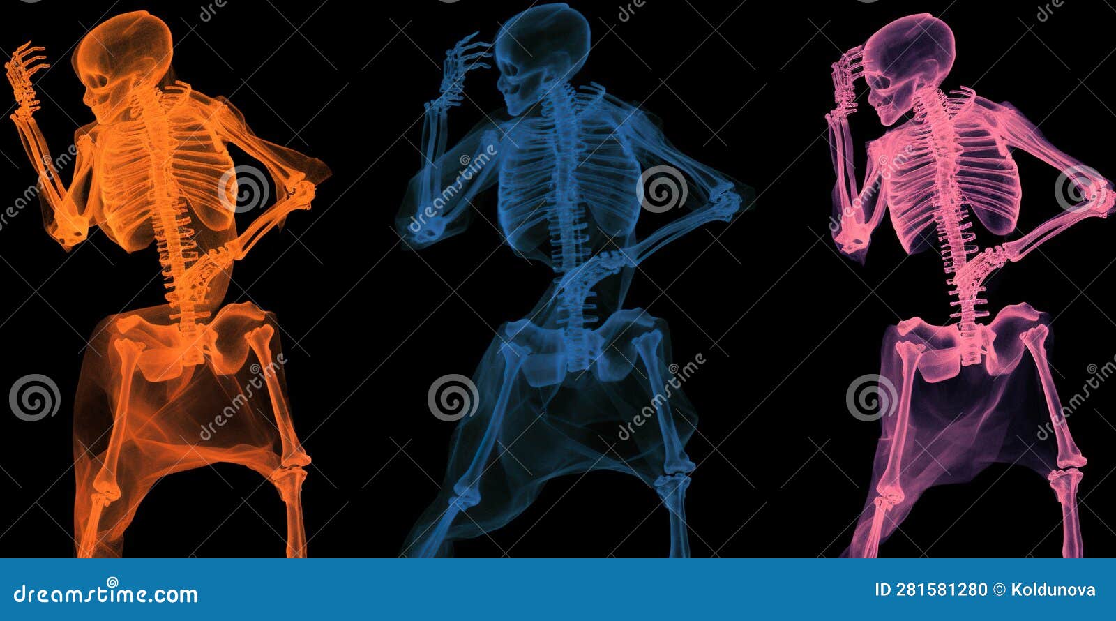 Dancing Xrays, Concept of Radiography Art, Created with Generative AI