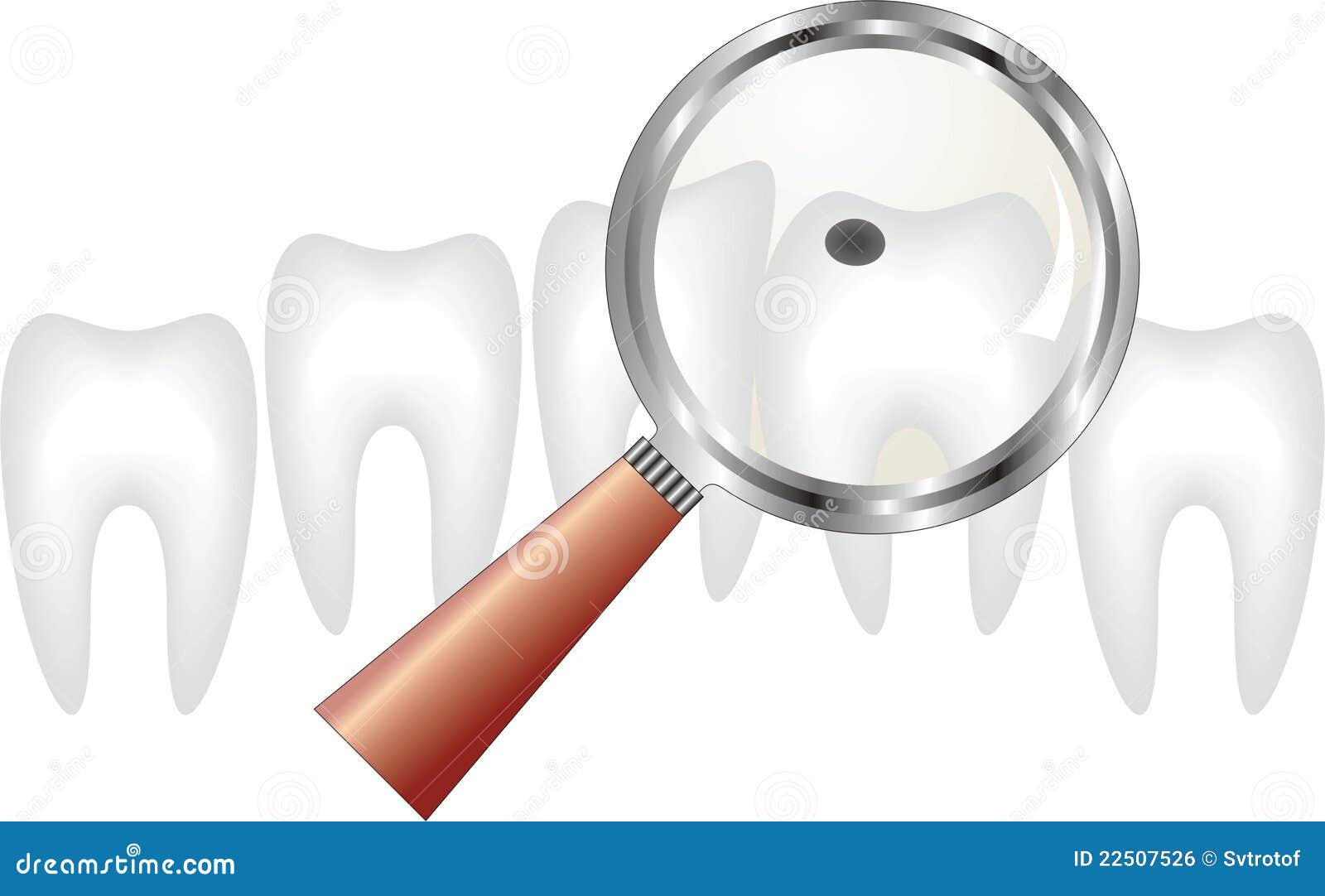 Decayed Tooth Under Magnifying Glass , Dentistry Stock Illustration