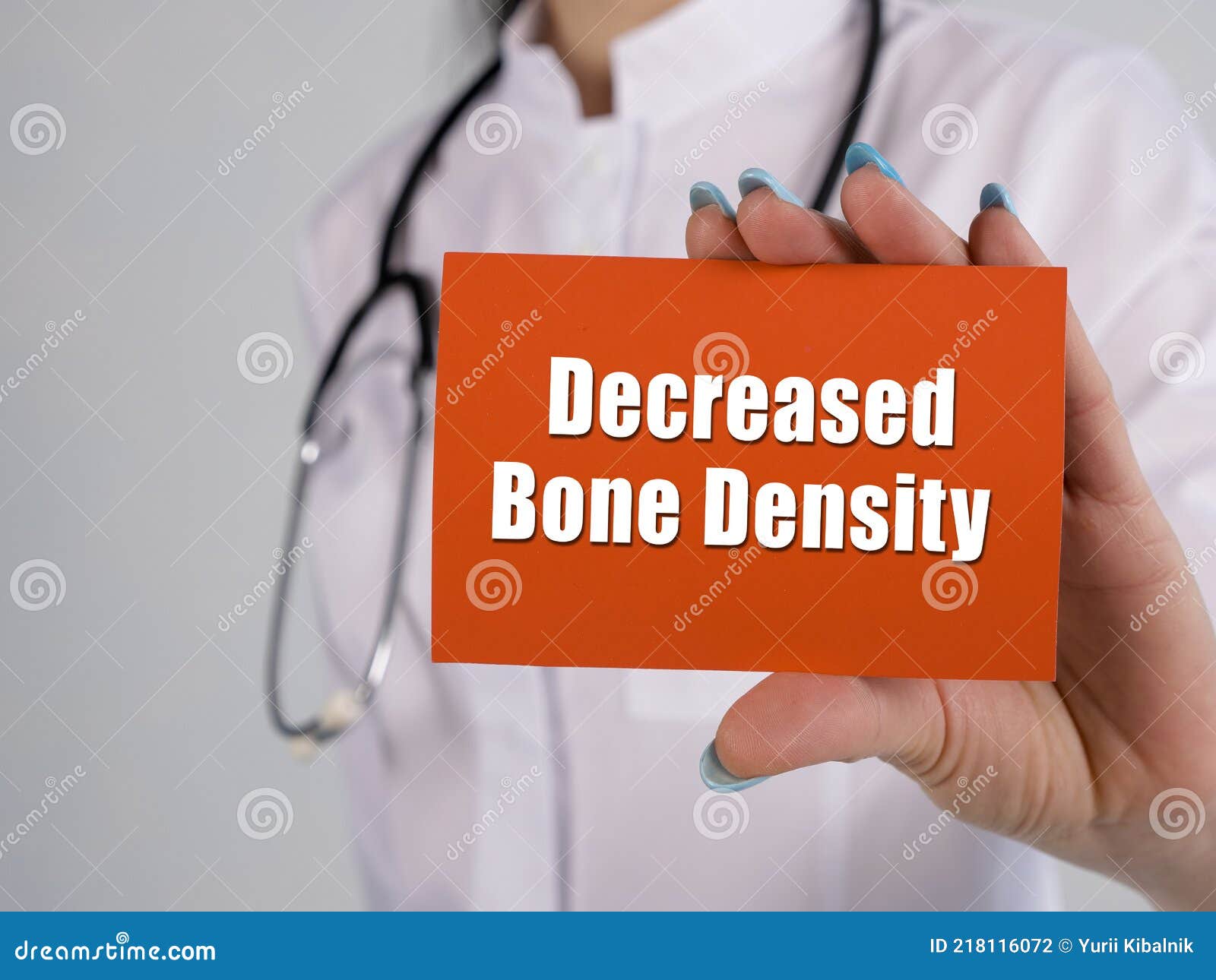 decreased bone density sign on the page
