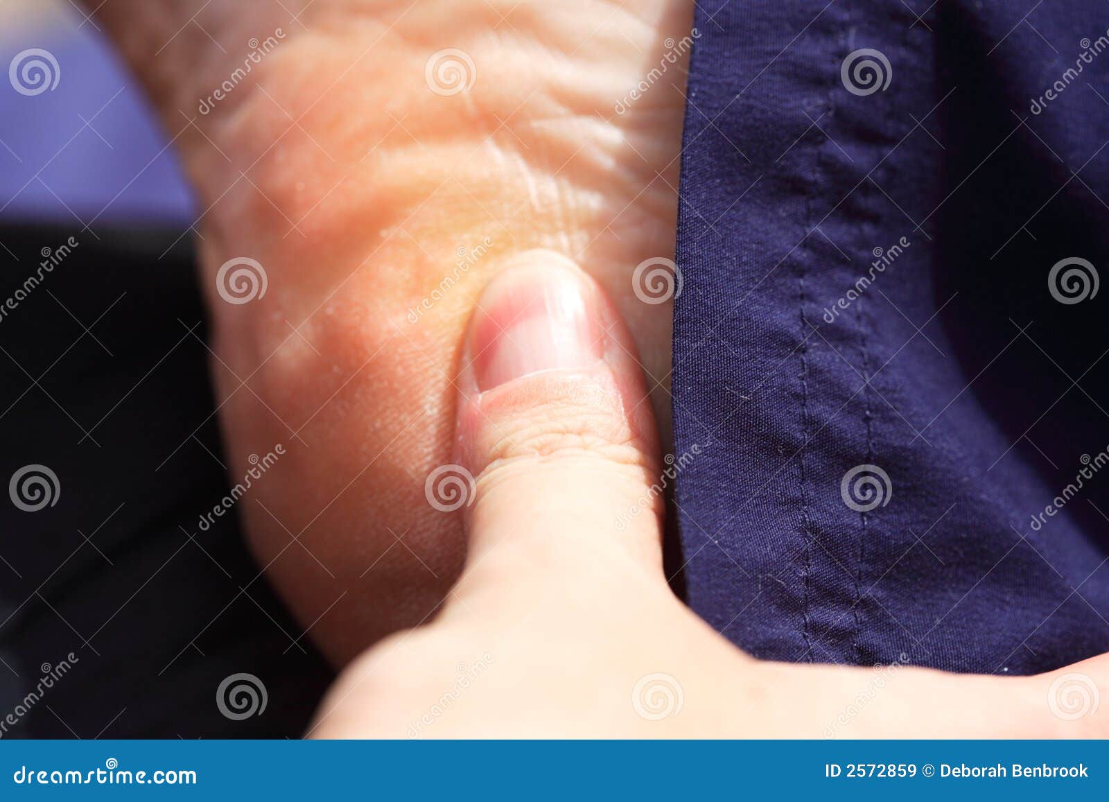 Deep tissue massage heel stock image. Image of pressure 2572859