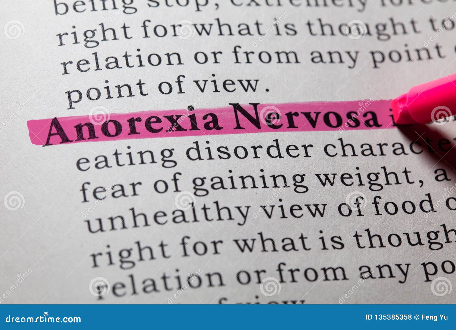 Реферат: What is Anorexiz Nervosa