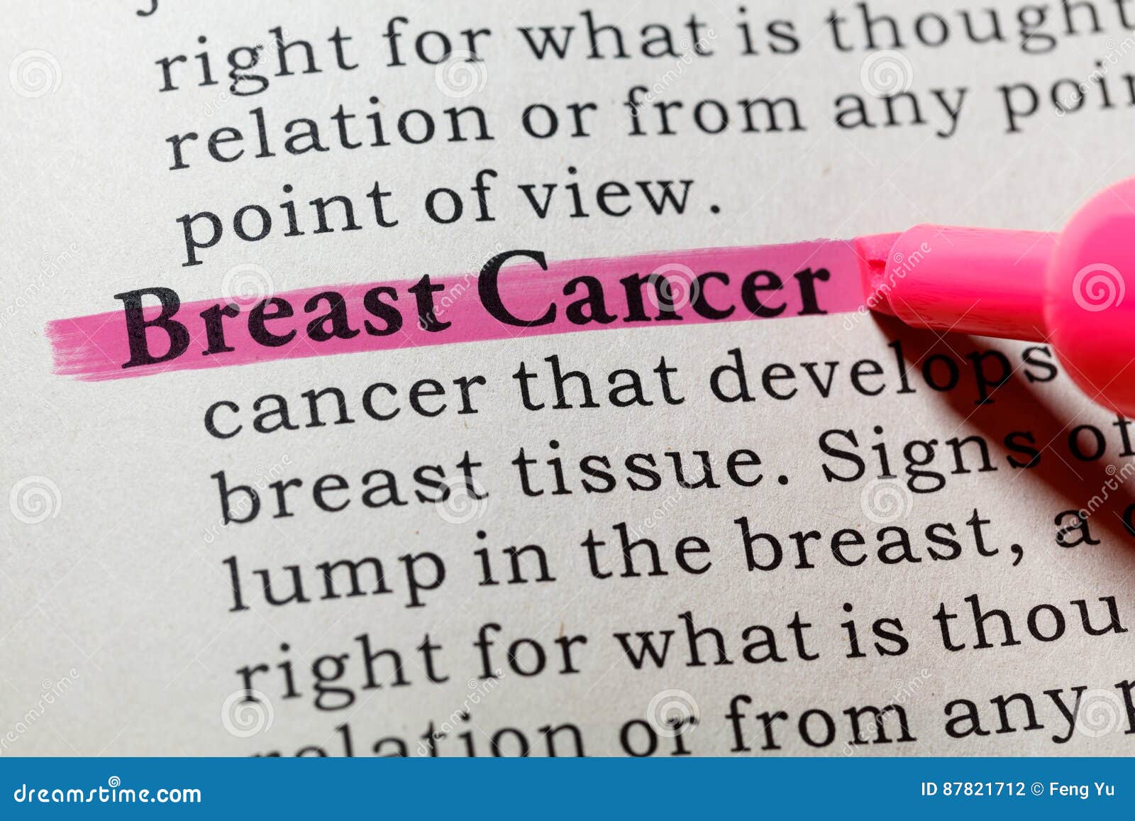 Definition of Breast Cancer Stock Photo - Image of close, book: 87821712