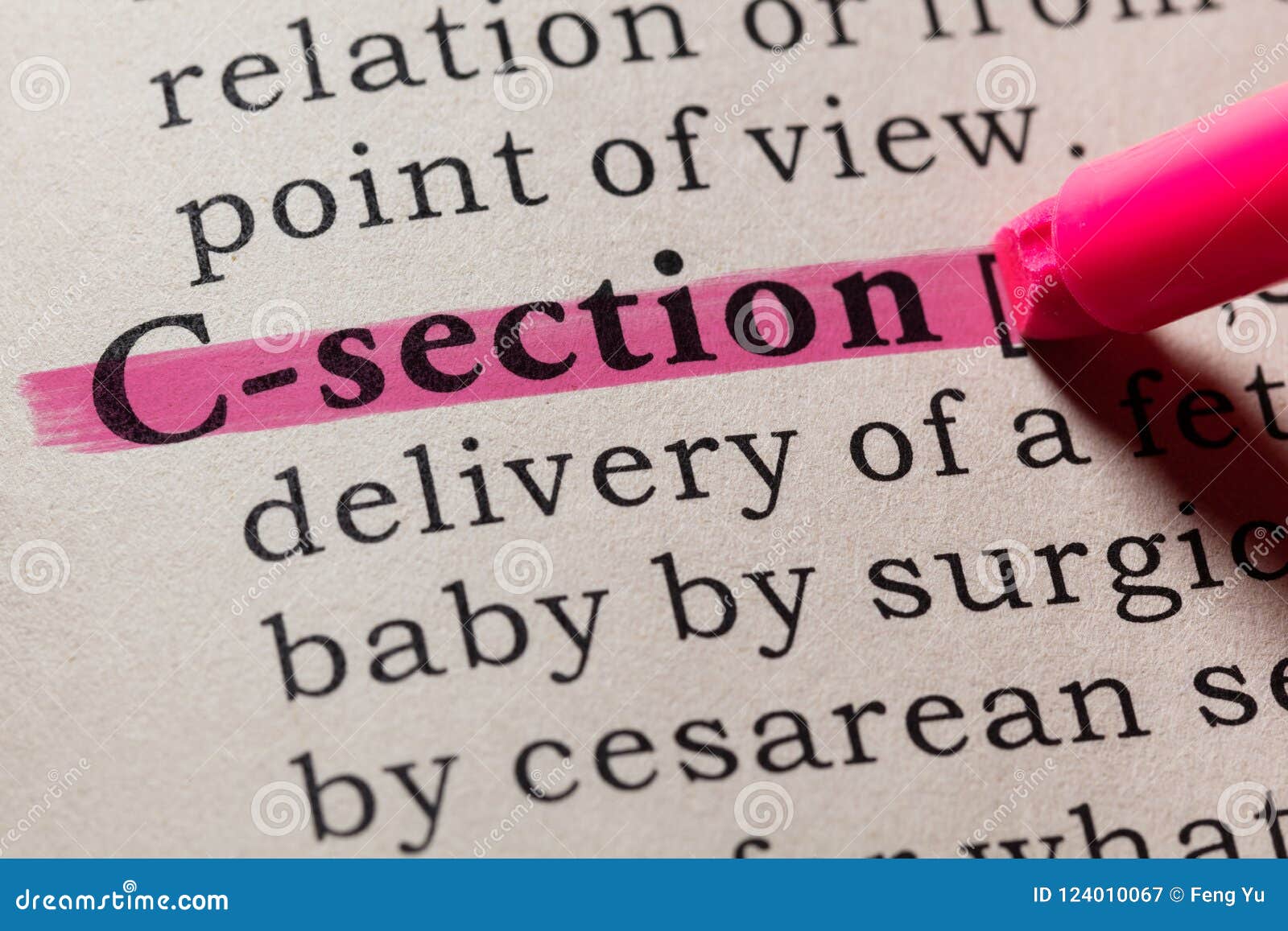 definition of c-section