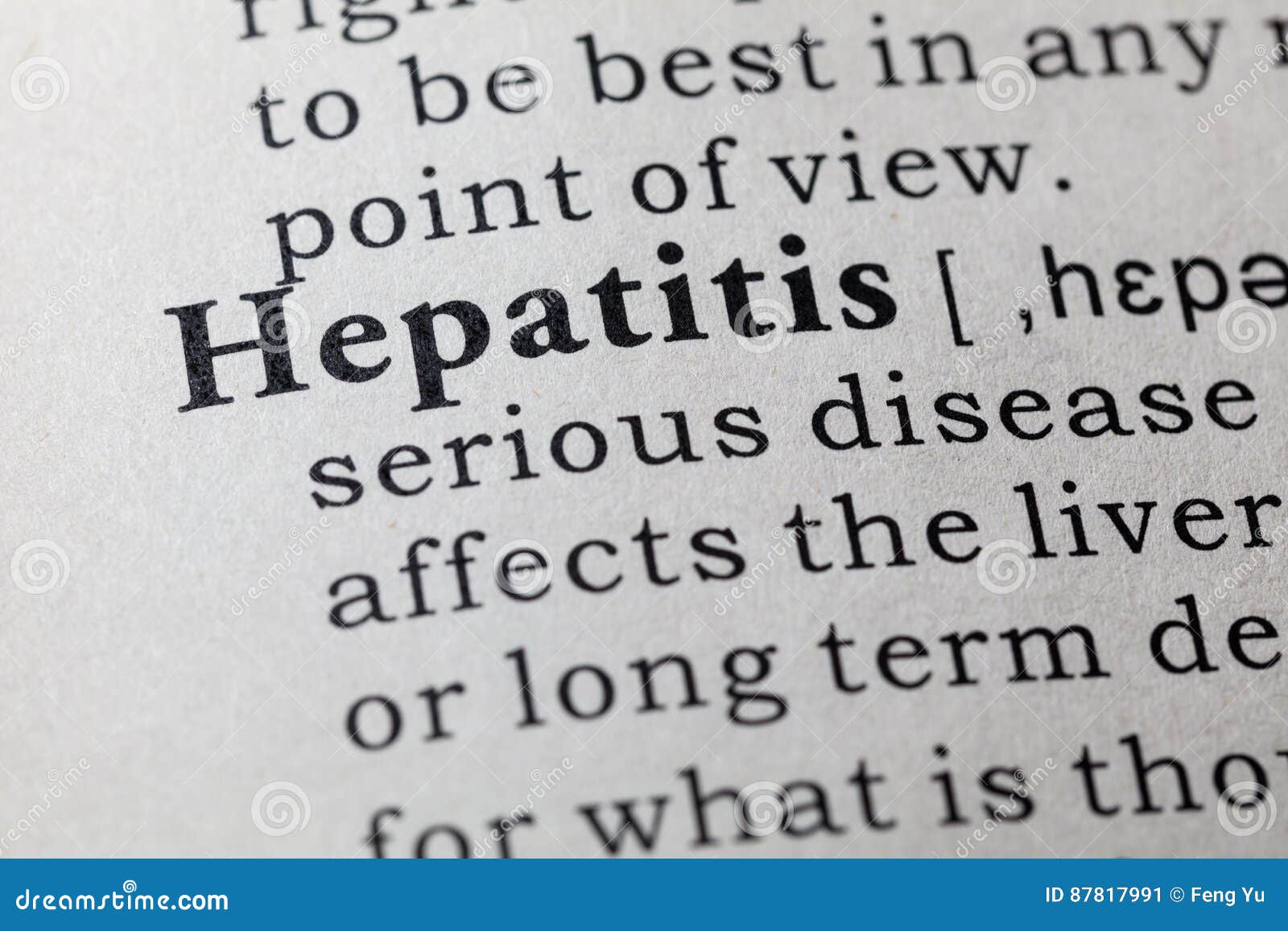 Definition of hepatitis stock image. Image of healthcare 87817991