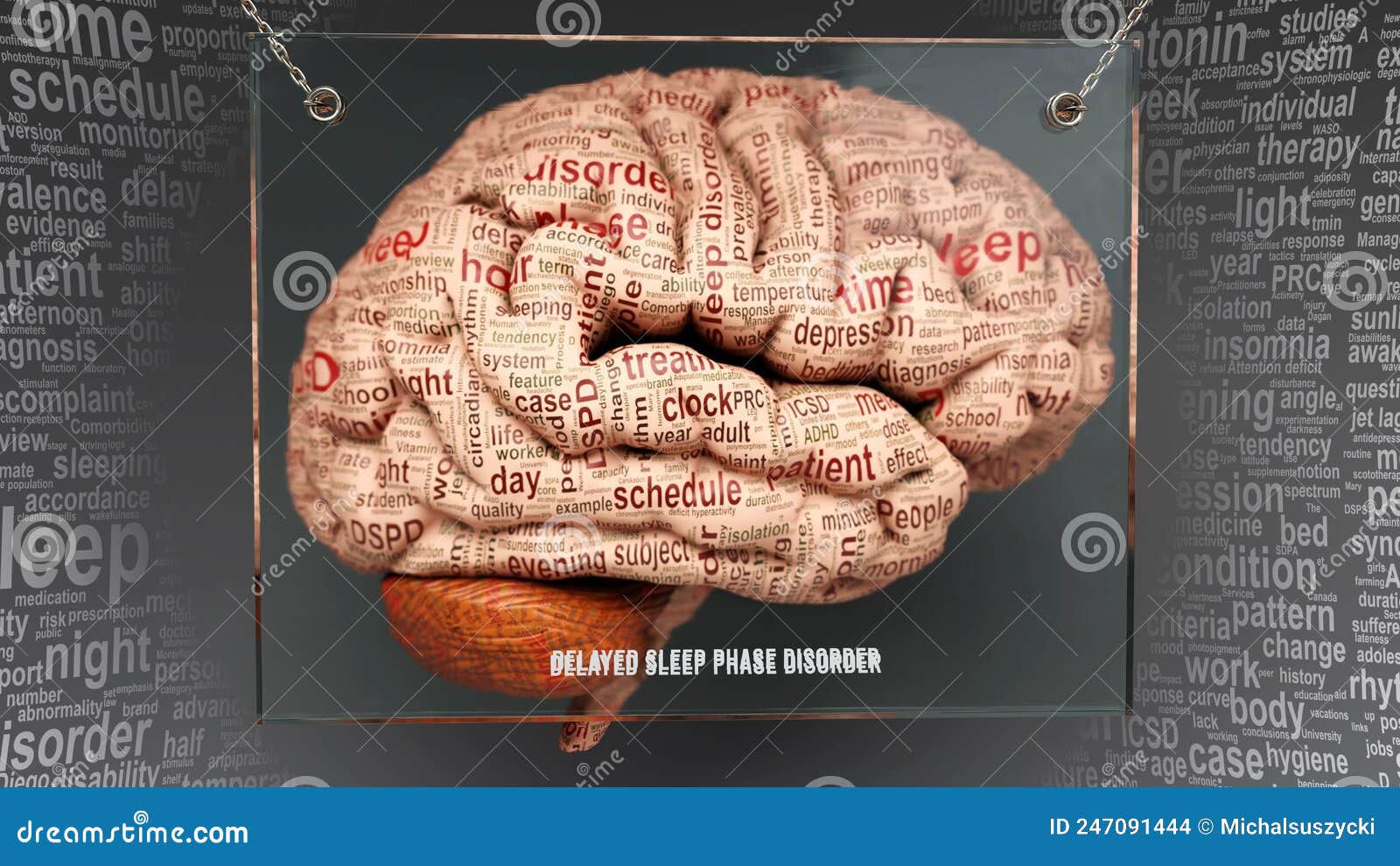 Investigating the best treatment for the Delayed Sleep Phase Syndrome ...