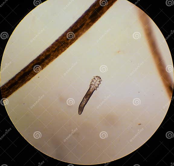 My Image 5