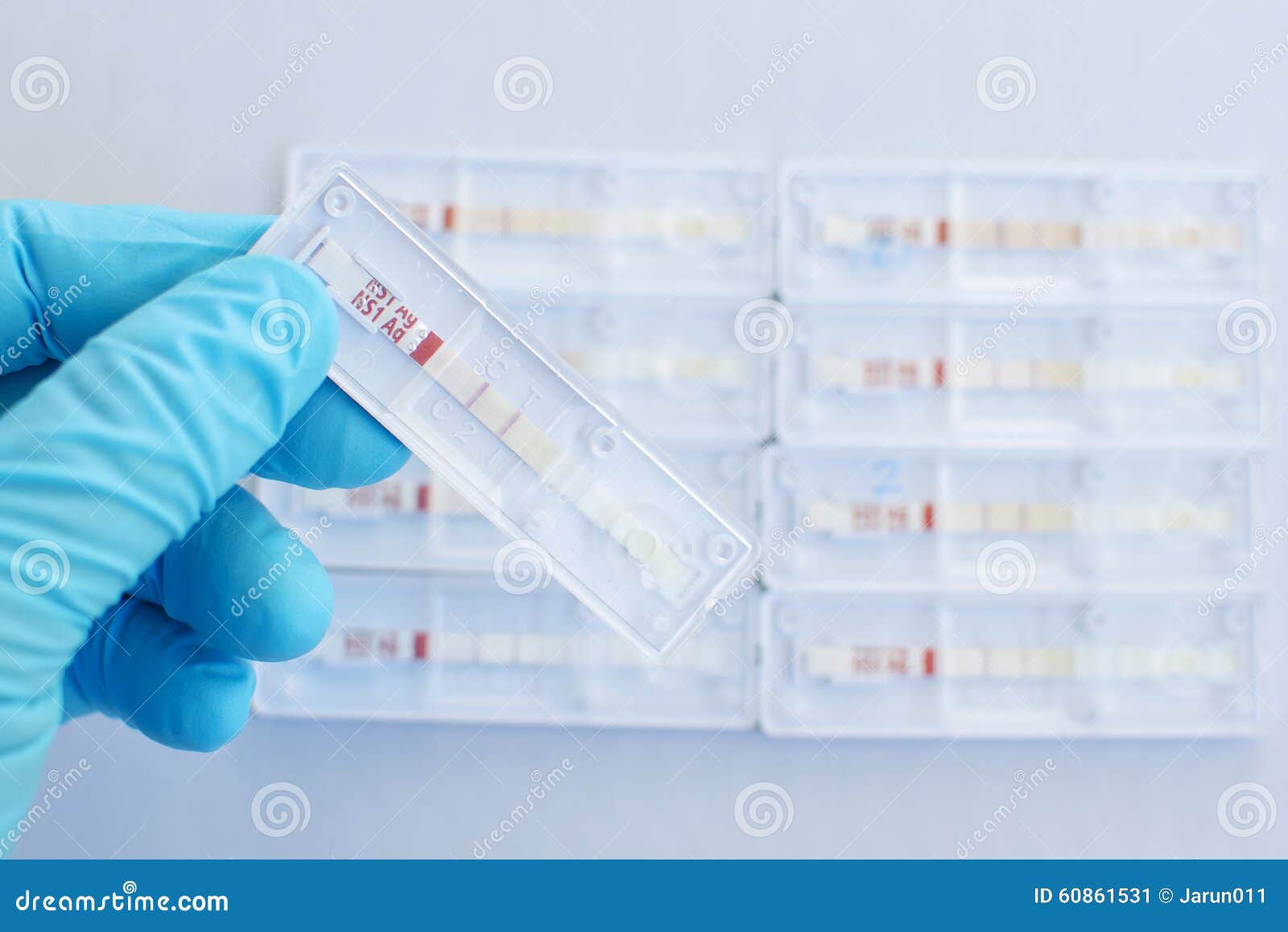 Dengue Testing Positive Stock Image Image Of Epidemic 60861531 dengue-testing-positive-stock-image-image-of-epidemic-60861531
