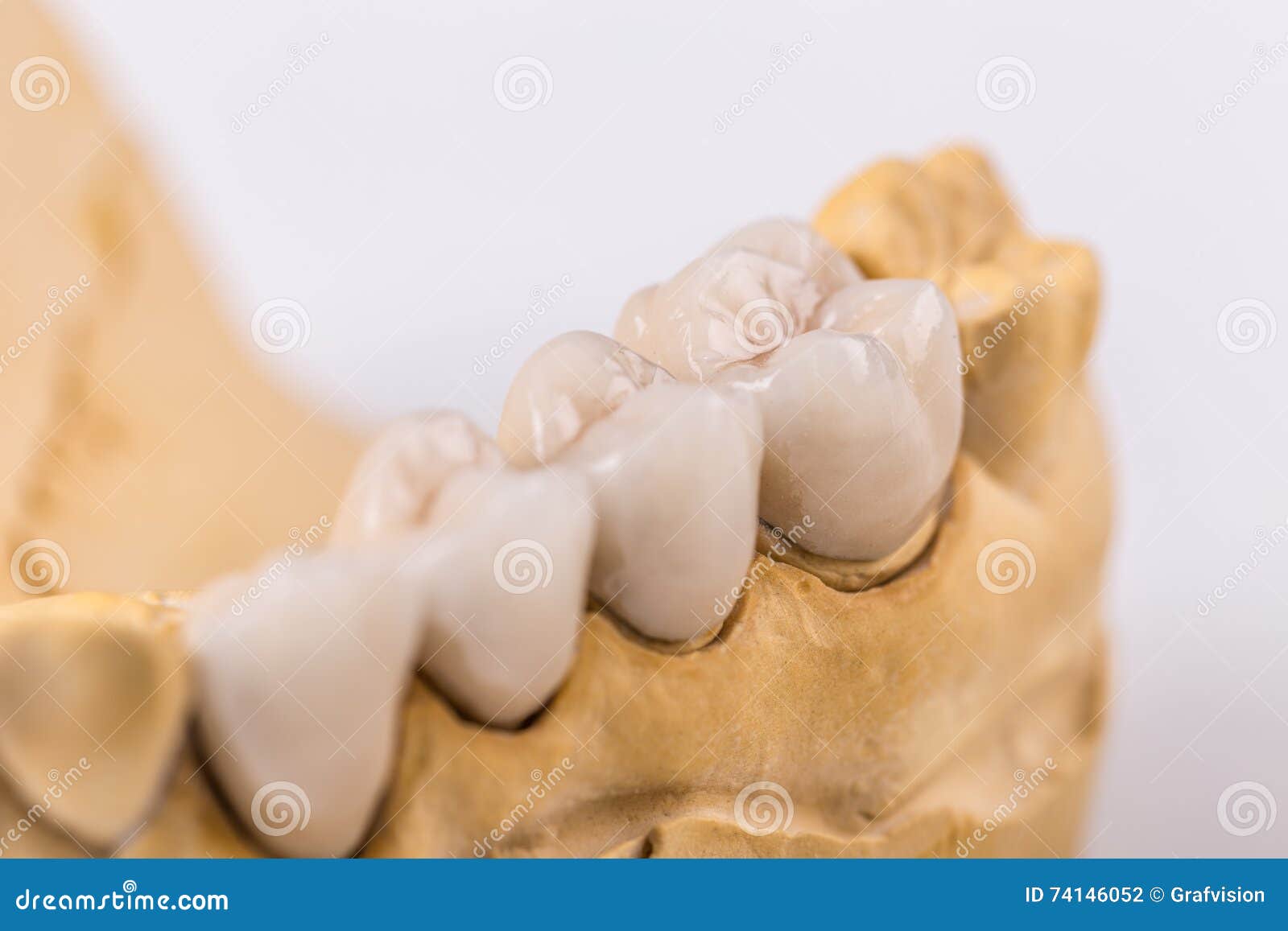 Dentadura Hecha De Cerámica Foto de archivo - Imagen de dentaduras