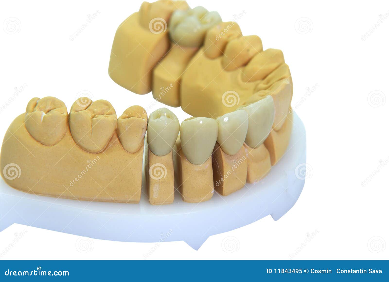Dentaduras Com Dentes Da Porcelana Ilustração do Vetor - Ilustração de