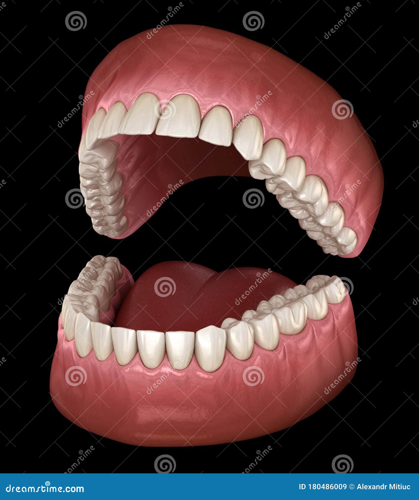 dental anatomy - opened dentures. medically accurate dental