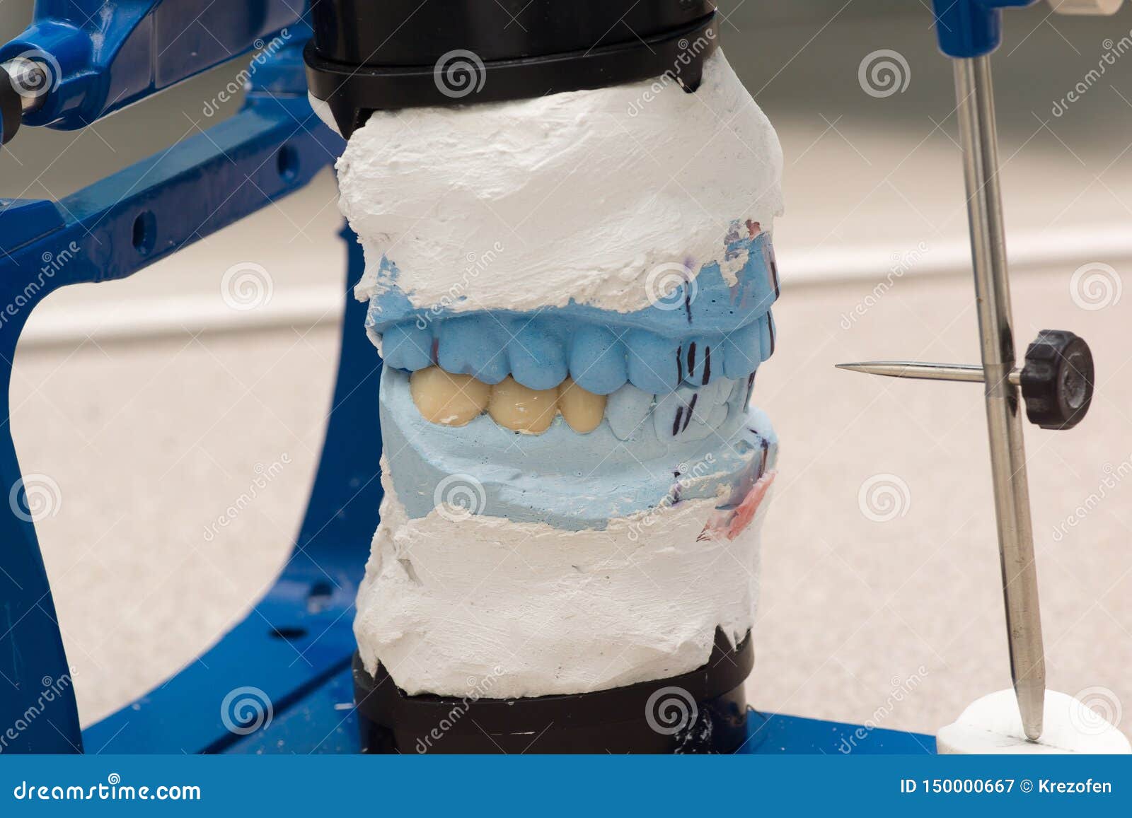 Dental Articulator with Plastered Dental Models Stock Image Image of