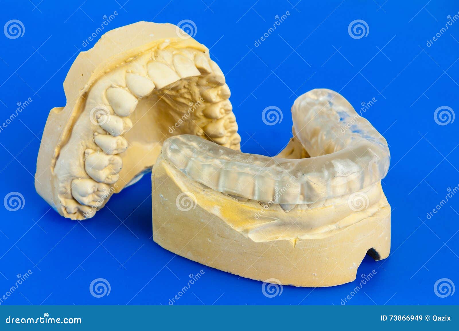 Dental Bite with Chalk Model Stock Image Image of stone, orthodontics