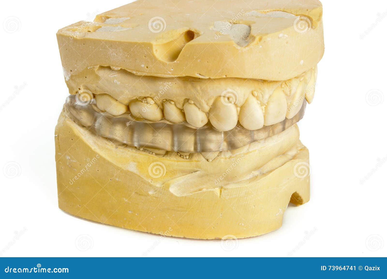 Dental Bite with Chalk Model Stock Image Image of dentist, safety