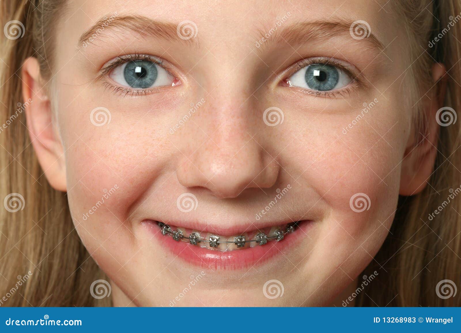Dental Braces stock image. Image of healthcare, human 13268983