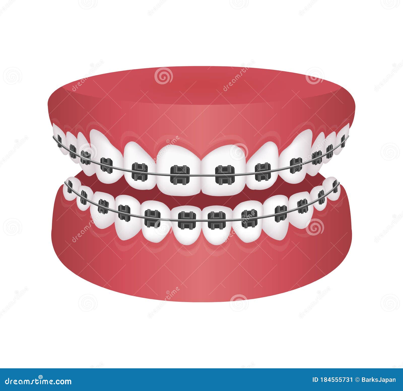 Dental Braces Flat Vector Illustration / No Text Stock Vector