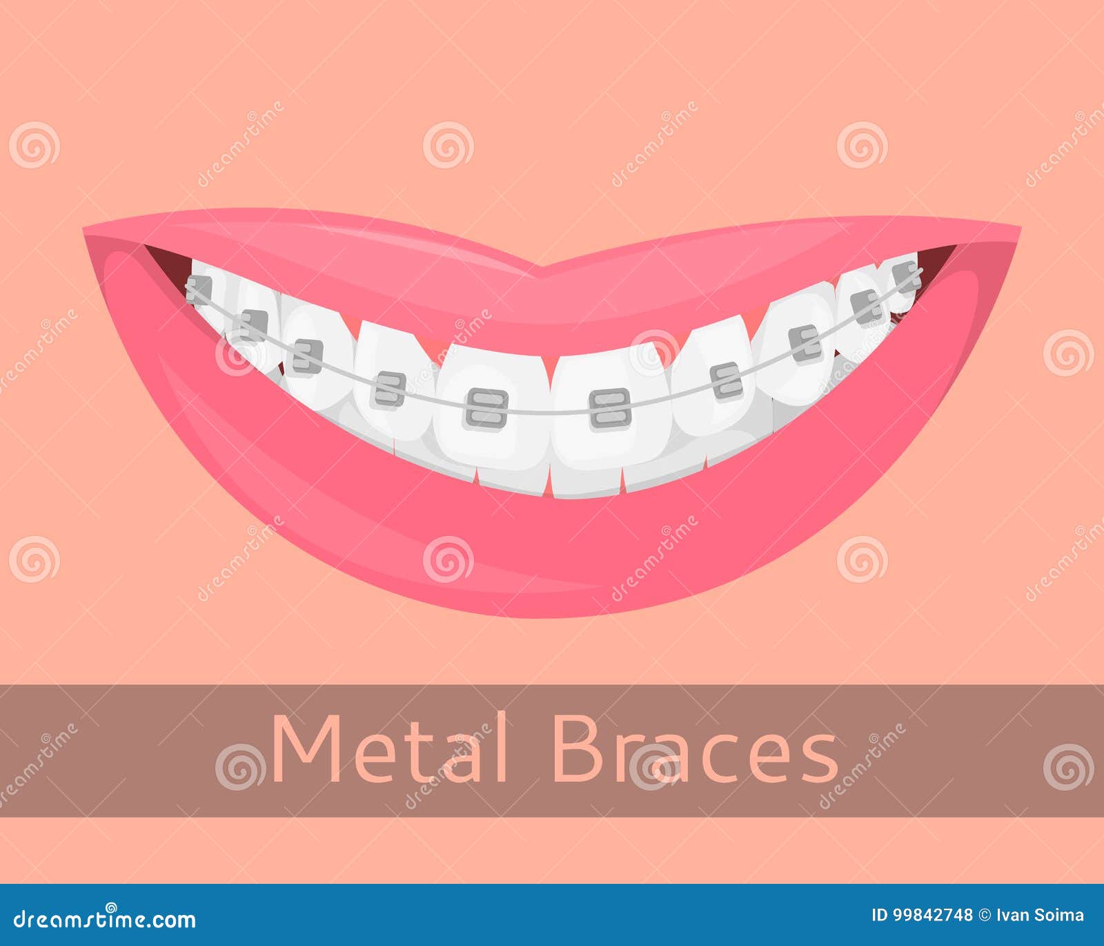 Teeth Braces Cartoon Smile Stock Illustrations – 1,500 Teeth Braces Cartoon Smile Stock Illustrations, Vectors & Clipart - Dreamstime Teeth Braces Cartoon Smile Stock Illustrations – 1,500 Teeth Braces Cartoon Smile Stock Illustrations, Vectors & Clipart - Dreamstime