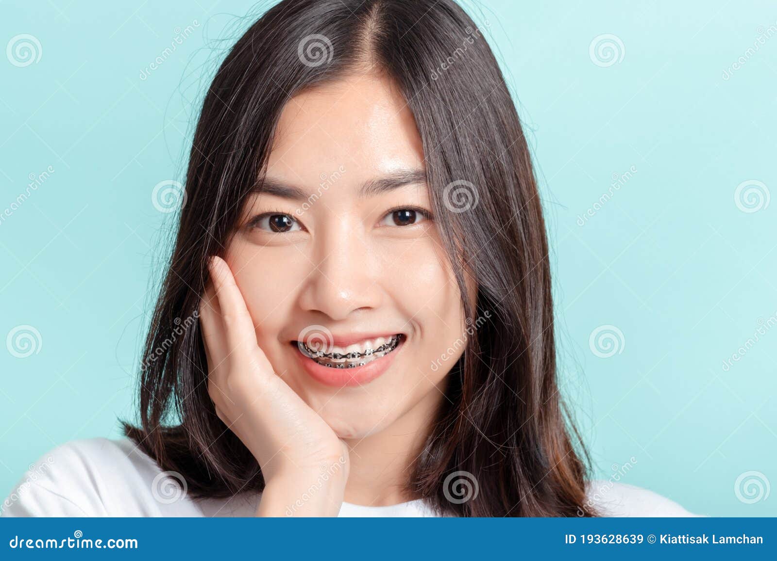 Dental Braces Of Young Asian Woman Wearing Braces Beauty Smile With