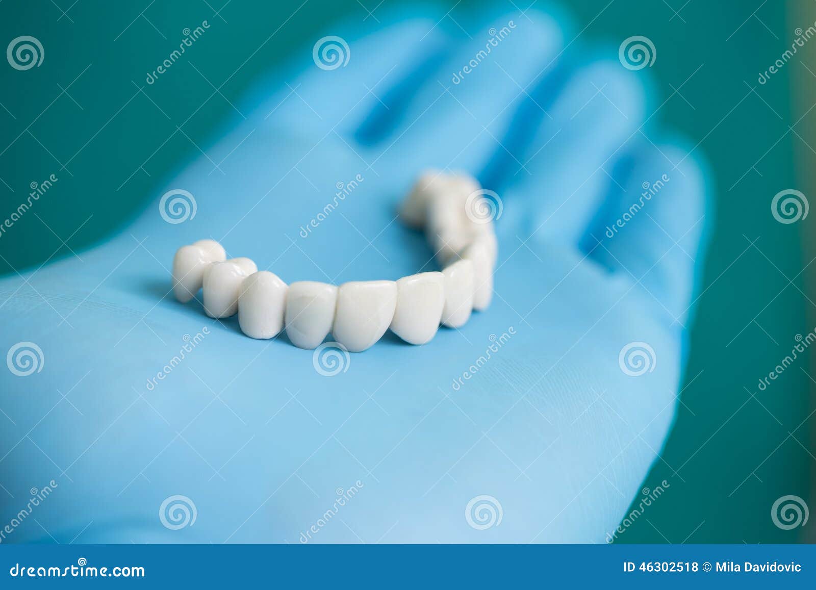 dental bridge