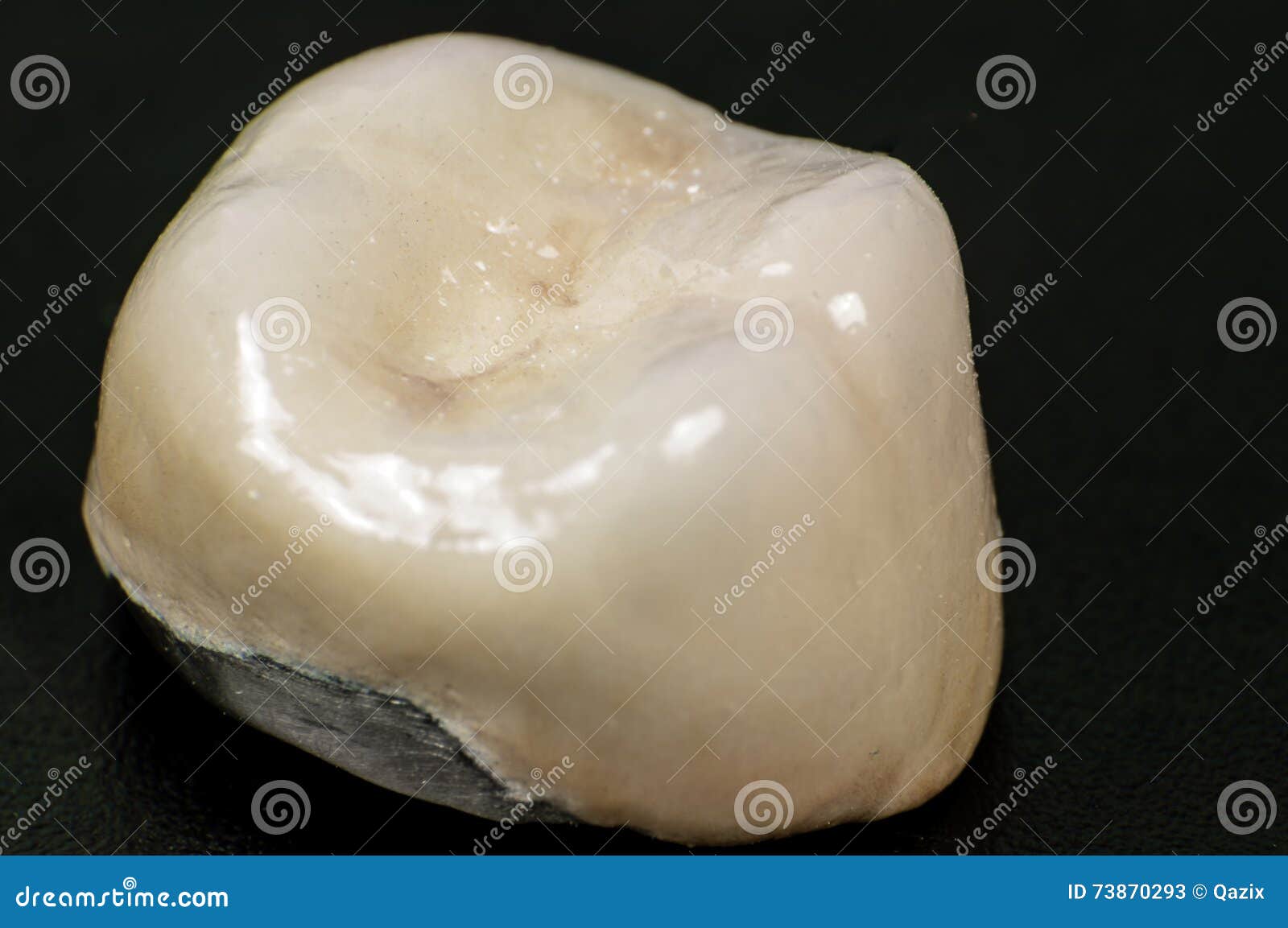 Dental capsule stock image. Image of implant, dentist 73870293