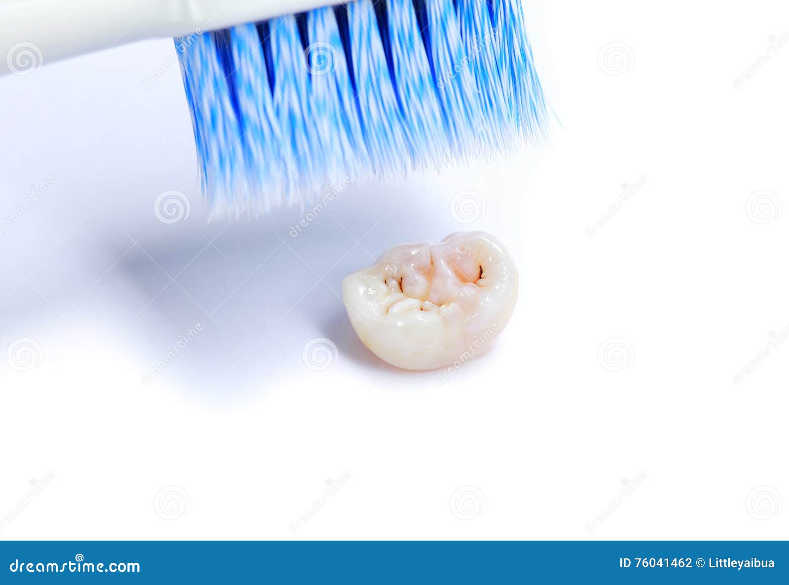 Dental Caries and Tooth Brush. Stock Photo Image of object, healthcare 76041462