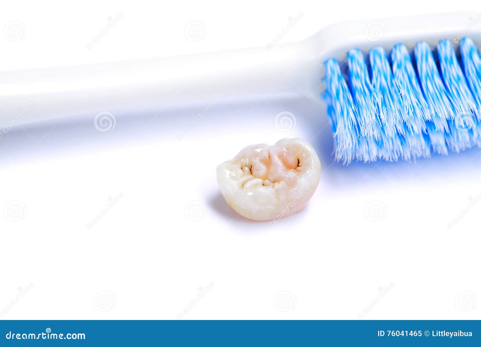 Dental Caries and Tooth Brush. Stock Image Image of caries, healthy 76041465