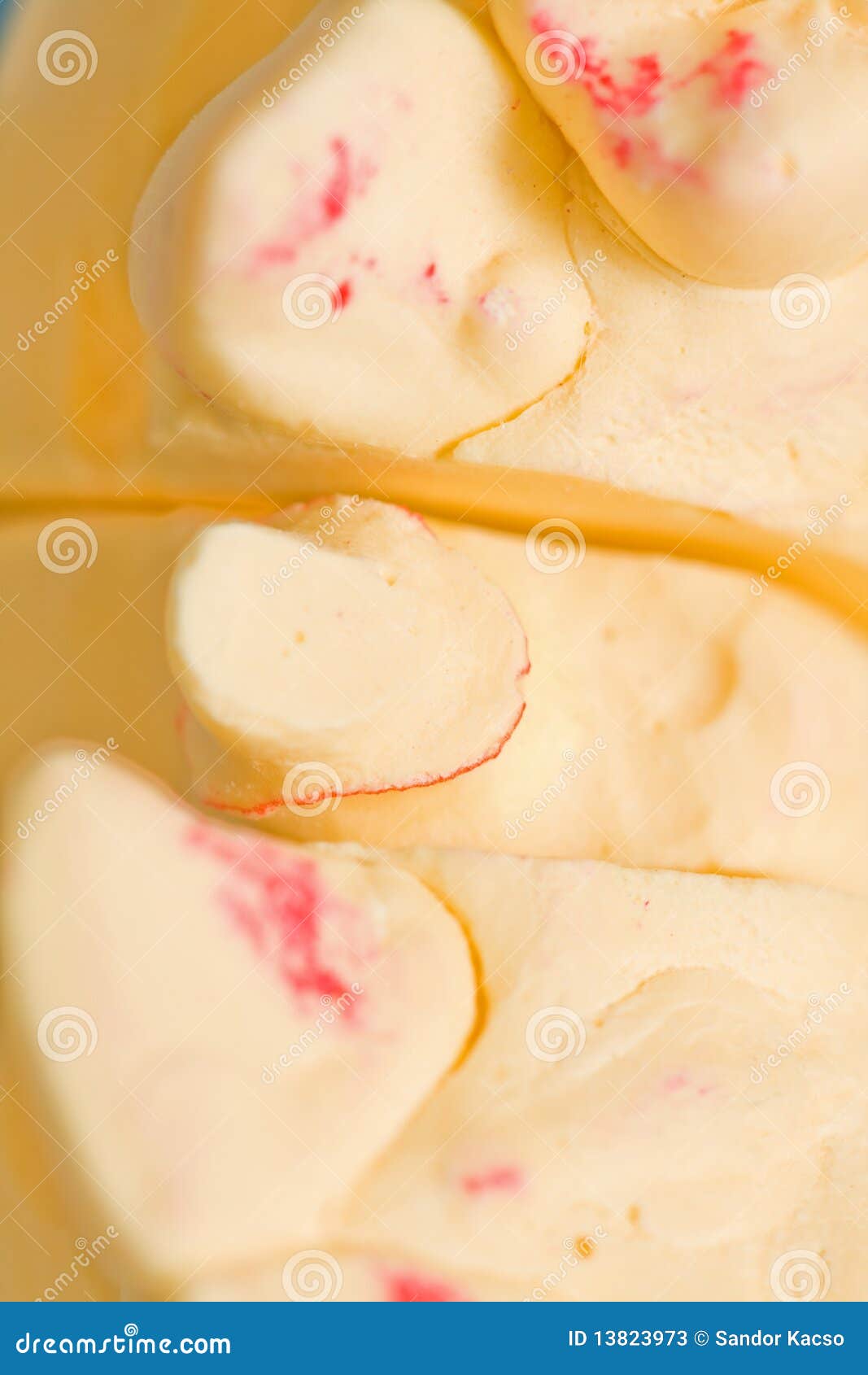 Dental Casting stock image. Image of dentist, clinical 13823973