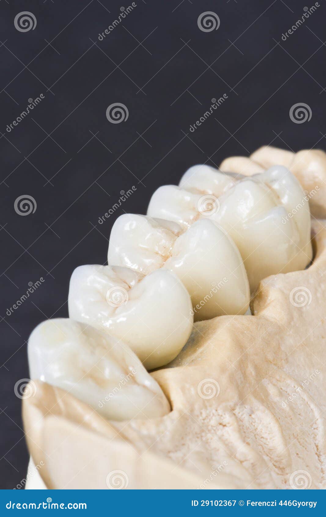Dental ceramic bridge stock image. Image of realistic 29102367