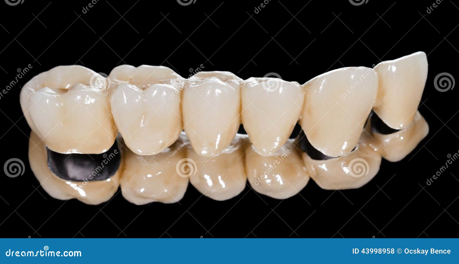 Dental ceramic bridge stock photo. Image of occlusal 43998958
