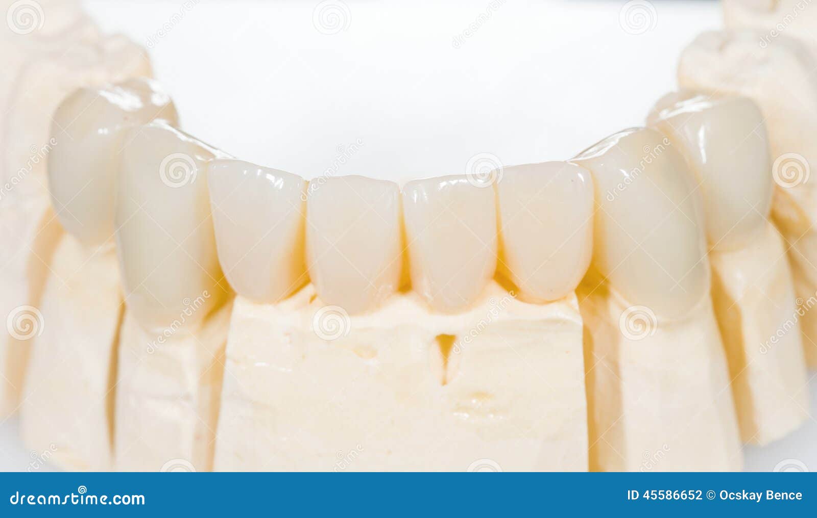 Dental ceramic bridge stock photo. Image of medical, artificial 45586652