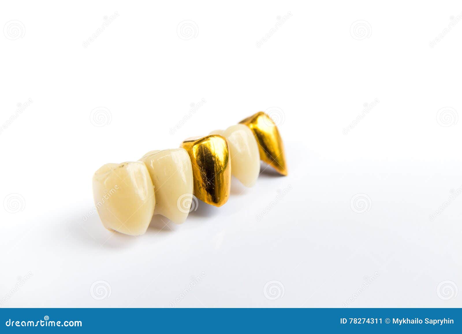 Dental Ceramic and Gold Tooth Crowns on White Background. Stock Image