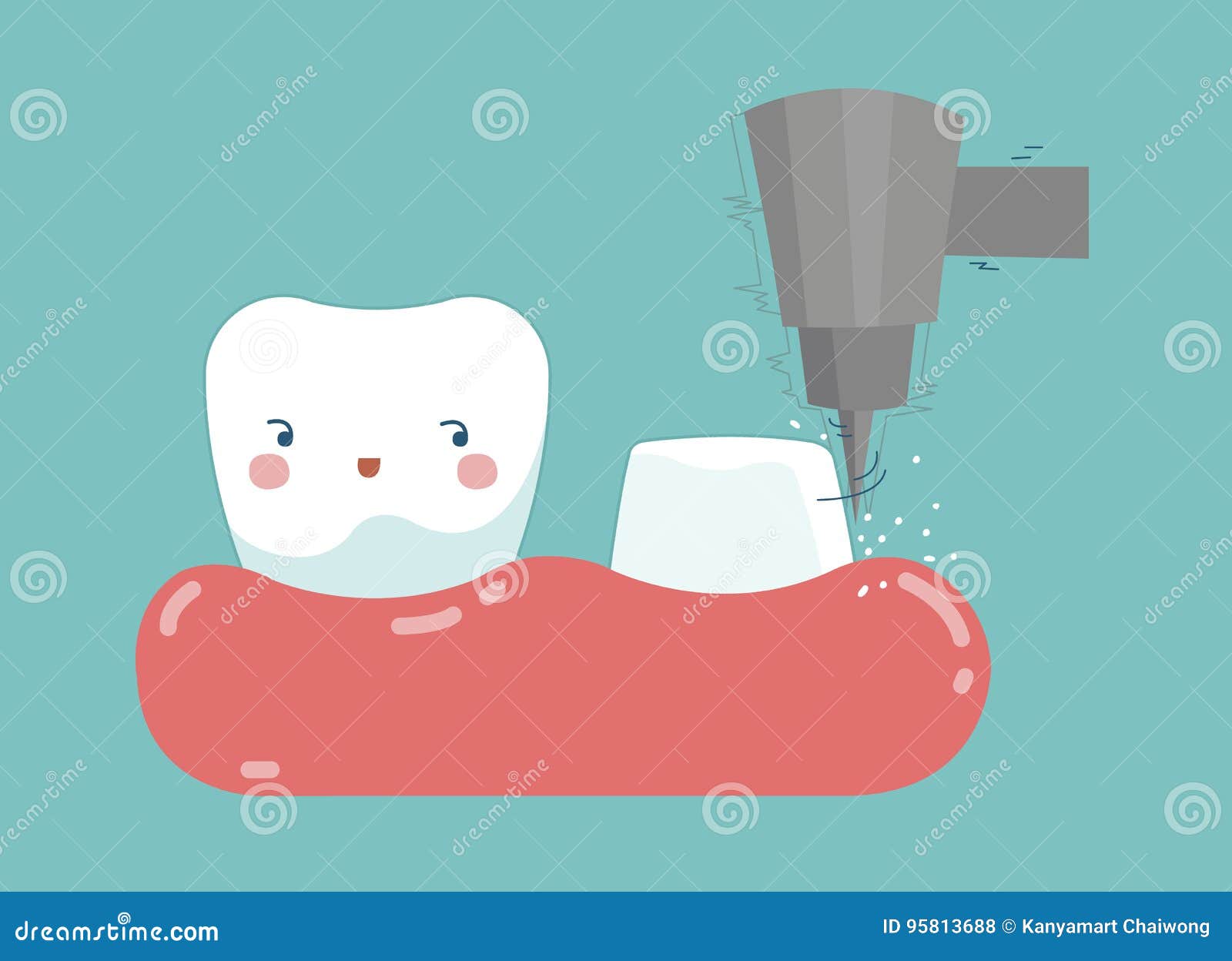 Dental Crown, Tooth Put In Crown, Dental Cartoon Concept