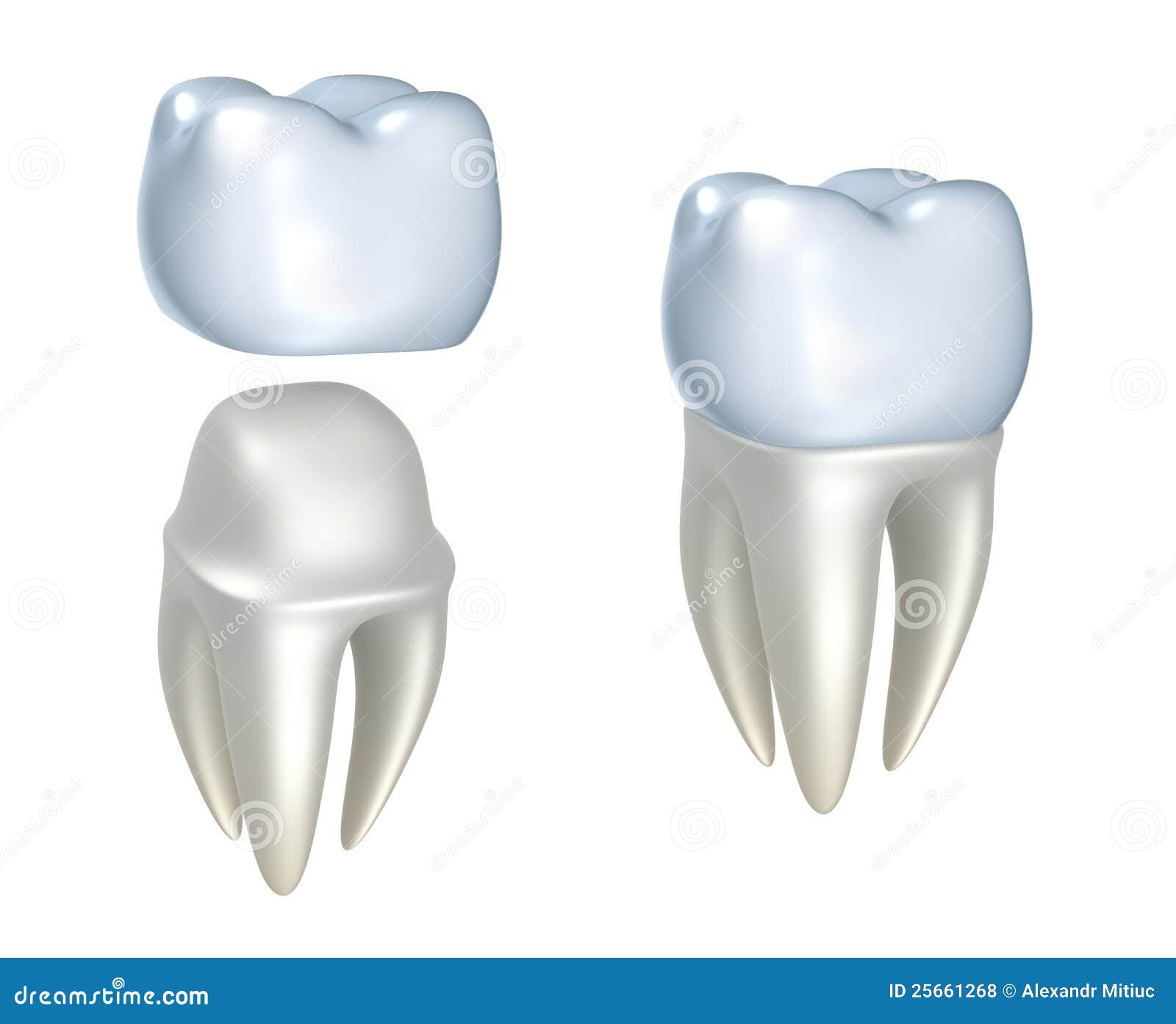 Dental crowns and tooth stock illustration. Illustration of keeping