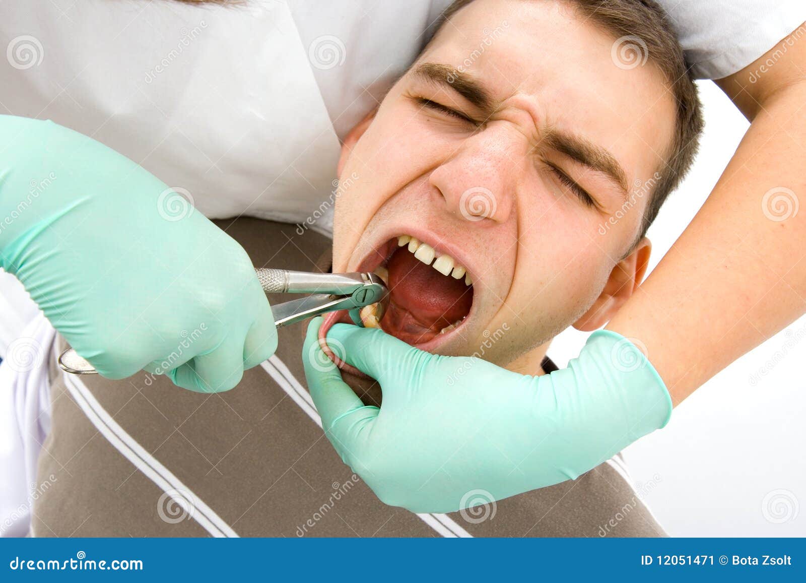 dental extraction