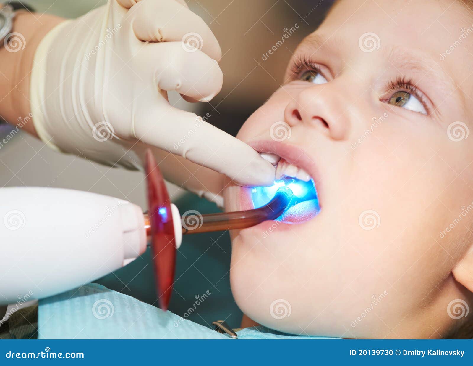 Dental Filing of Child Tooth by Stock Photo Image of dentist, curing